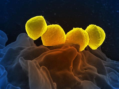 Image result for Scanning Electron Microscope Images