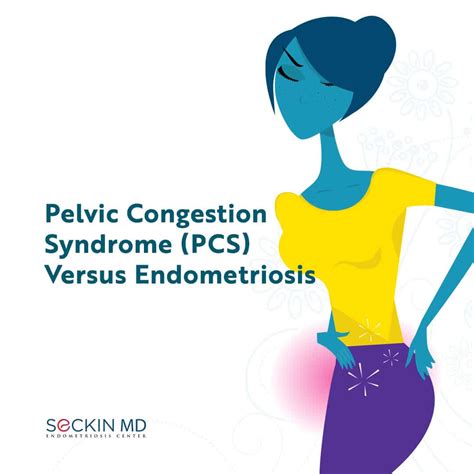Pelvic Congestion Syndrome (PCS) Versus Endometriosis