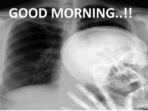 Image result for Normal X-ray