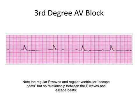 Image result for ACLS Code Blue Algorithm