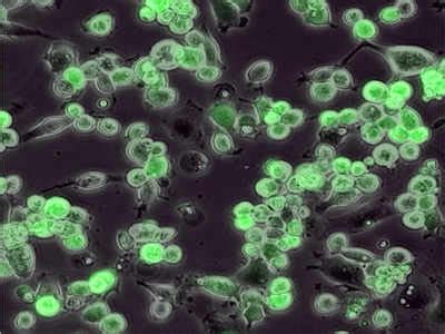 Can this deadly virus kill cancer? Scientists experiments!