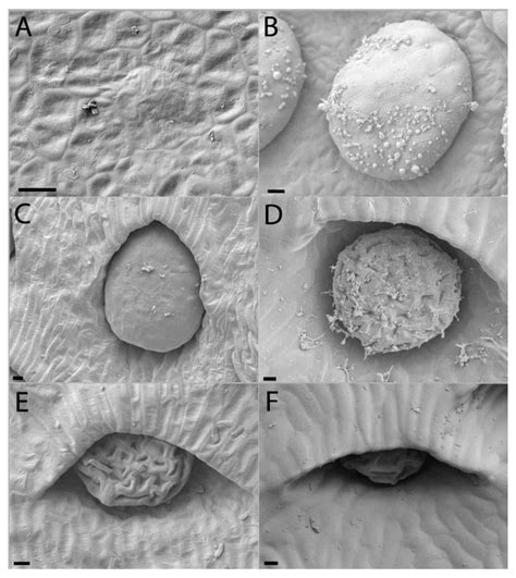 Ontogeny and Anatomy of the Dimorphic Pitchers of Nepenthes rafflesiana ...