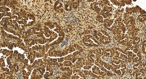 THOC3 antibody (11716-1-AP) | Proteintech