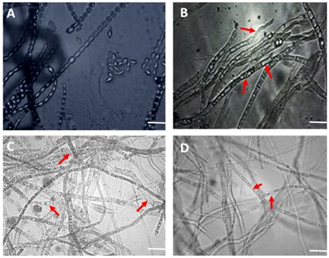 Improving the Biocontrol Potential of Bacterial Antagonists with ...
