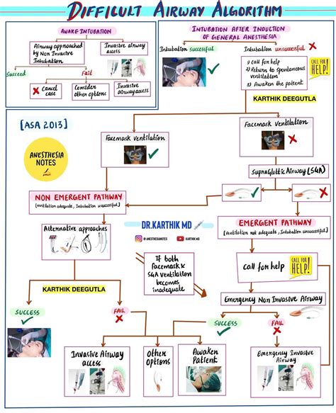 Anesthesianotes - ASA DIFFICULT AIRWAY ALGORITHM...