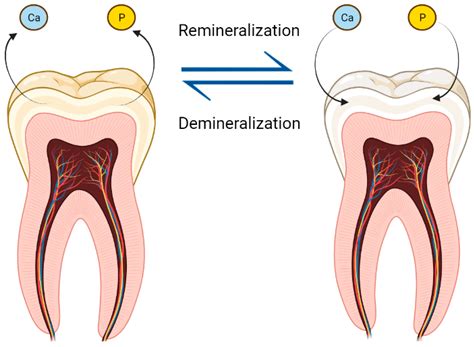 New Technological Approaches for Dental Caries Treatment: From Liquid ...