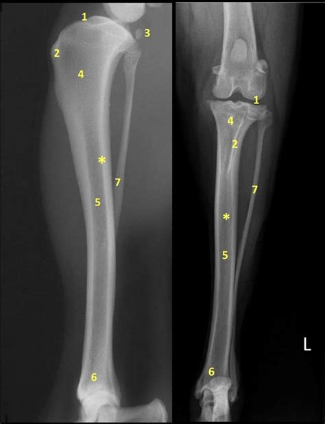 Image result for Ribstride Tibia