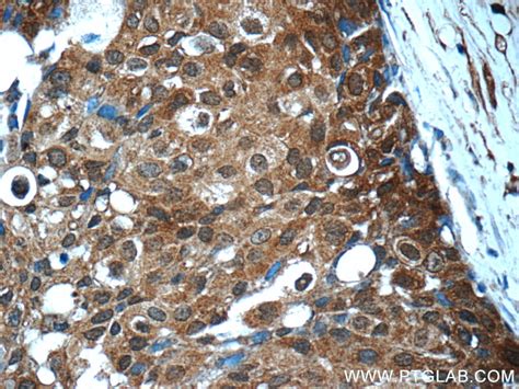STAT3 antibody (60199-1-Ig) | Proteintech