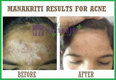 Patient Reviews For Manakriti Homeopathic Clinic In Ahmedabad