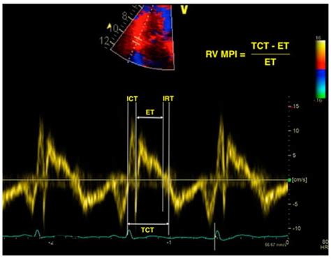 Diagnostics | Special Issue : Echocardiography