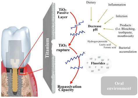 Titanium Implants Side Effects