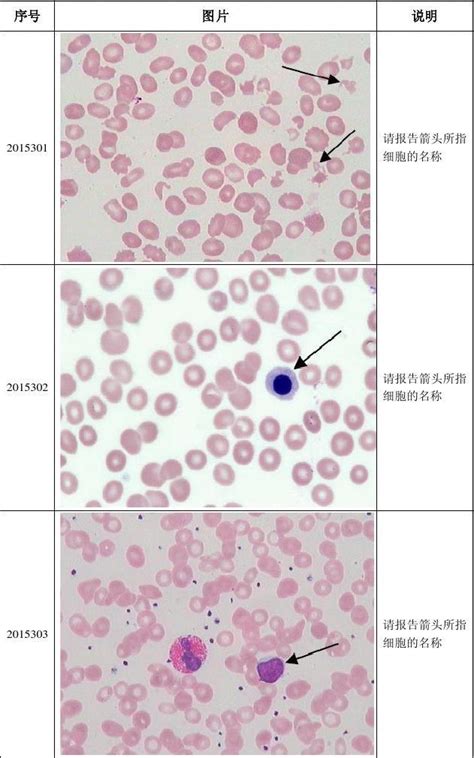 2015年第3次血细胞形态学检查室间质量评价._word文档在线阅读与下载_文档网