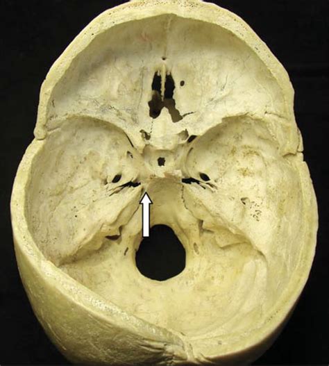 Superior View of the Skull Base | Neuroanatomy | The Neurosurgical Atlas