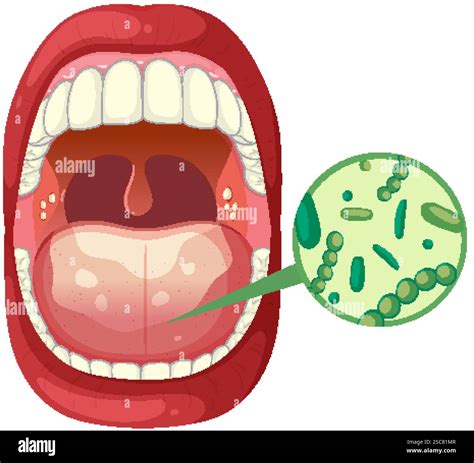 Open mouth showing bacteria and oral health Stock Vector Image & Art ...