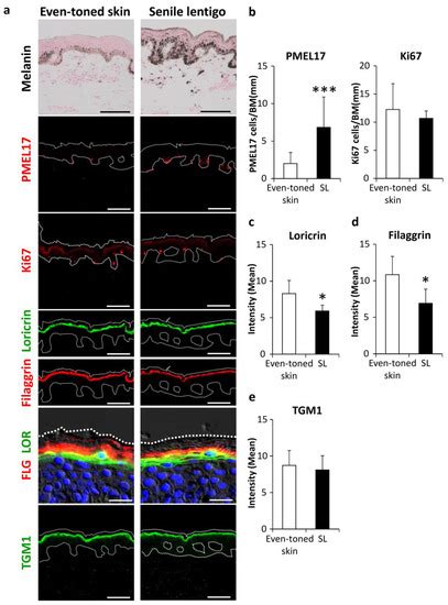 Autophagy Declines with Premature Skin Aging resulting in Dynamic ...