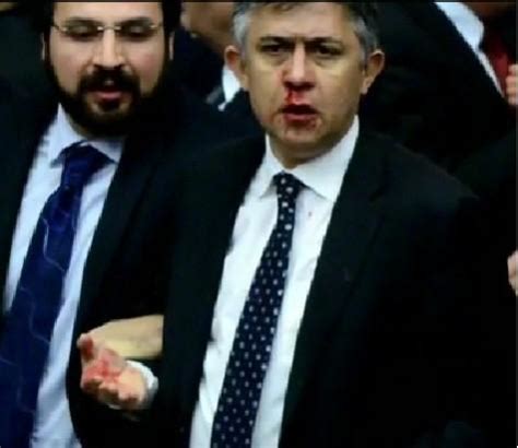 Another Brawl in Turkish Parliament Leaves MP With a Bloody Nose ...