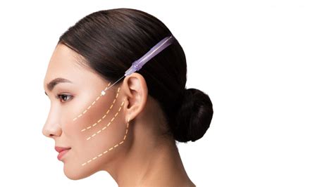 New Thread Lift 的图像结果