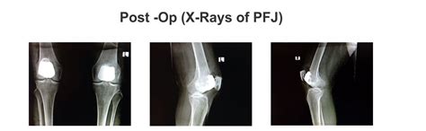 Orthonova Hospital - Jalandhar