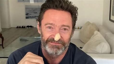 What is basal cell carcinoma, the skin cancer Hugh Jackman got screened ...