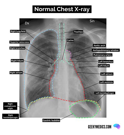 Image result for Normal X-ray