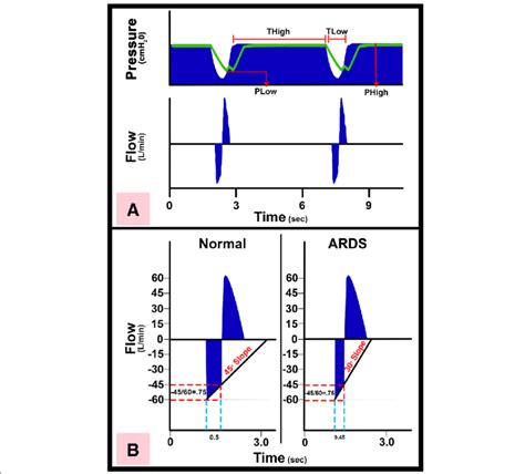 Image result for APRV Mode Explained