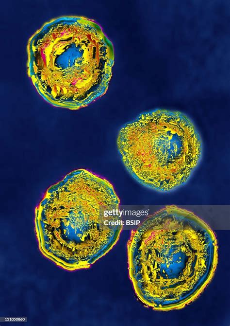 Image result for Simplex Virus 2