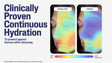 Cetaphil Gentle Skin Cleanser,Non Irritating Formula For All Skin Types ...