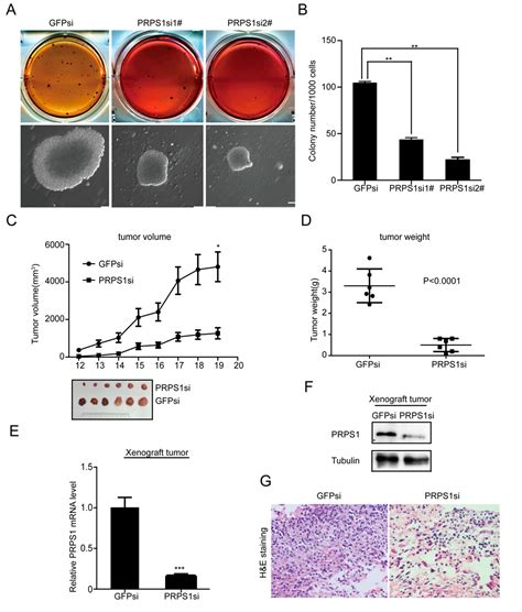 Down-Regulation of Phosphoribosyl Pyrophosphate Synthetase 1 Inhibits ...