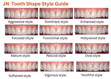 Tooth Shape Chart – JN Dental Lab