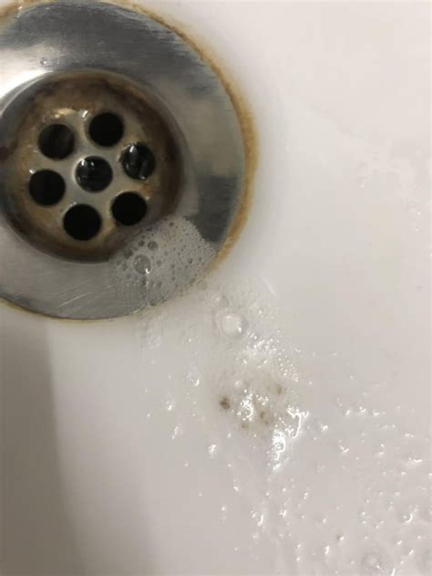 Brown specks in spit/spitum/ nit sure if its phlegm. : r/DiagnoseMe