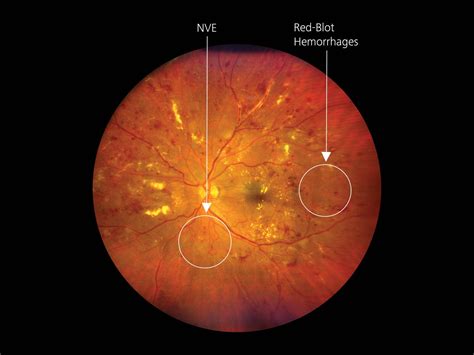 ZEISS CLARUS 700 Case Studies