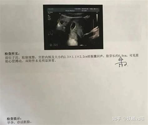 孕B超检查报告单，请大家帮我看看，怀孕多久了，胎儿健康吗、 - 百度宝宝知道