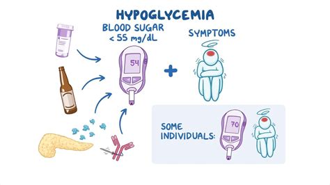 A Hypoglycemia Many Have Symptoms Of Low Blood Sugar Levels Even