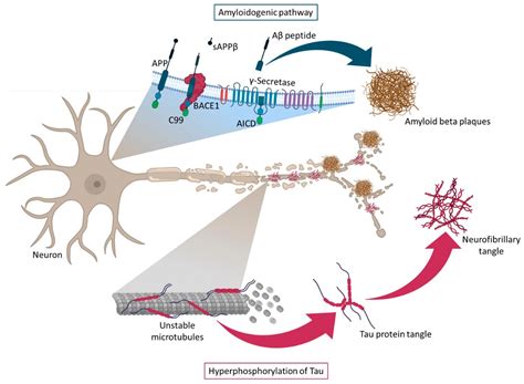 New RNA-Based Breakthroughs in Alzheimer’s Disease Diagnosis and ...