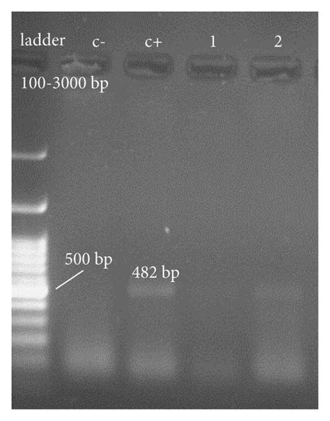Image result for Negative Control for SysV