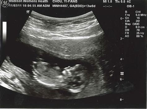 [懷孕] 13週- 健康寶寶 | 我在二樓