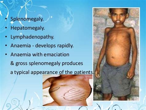 Image result for Alienware 17 GTX 960