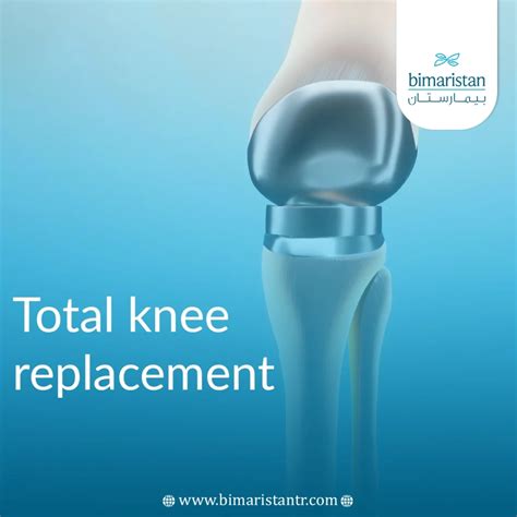 Knee Replacement Surgery in Turkey - بيمارستان