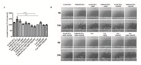 Estrogen Receptor α Is Crucial in Zearalenone-Induced Invasion and ...