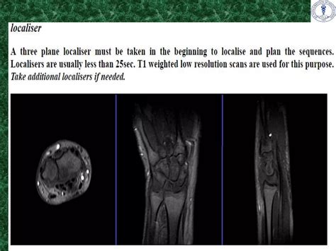 Anatomy and imaging of wrist joint (MRI AND XRAY) | PPTX