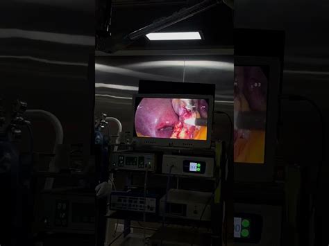 Urology Instruments - Telepack Endoscopy System Manufacturer from Ghaziabad