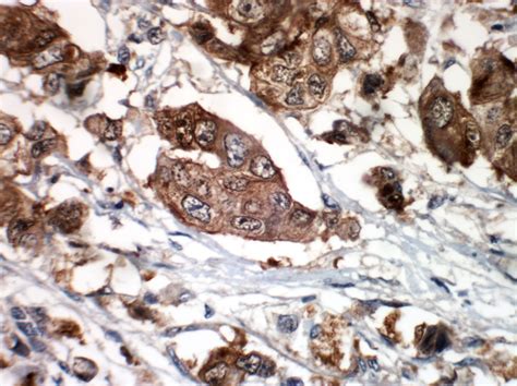 CDK4-EP180 | PathnSitu Biotechnologies