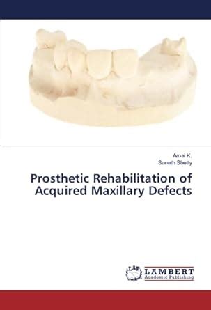 Prosthetic Rehabilitation of Acquired Maxillary Defects : Amazon.in: Books