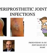 Image result for periproctitis