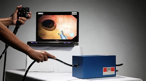 Risks vs. Benefits of Colonoscopies