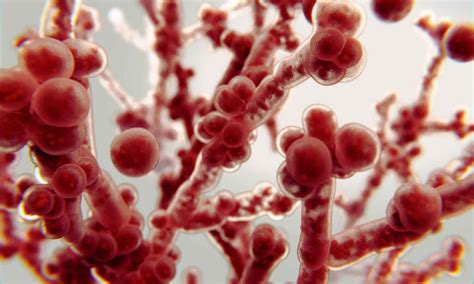 Laser therapy enhances treatment of fungus resistant to conventional ...