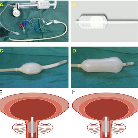 Image result for Patient Bad Example