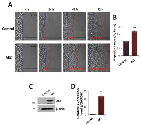 Intracellular Ca2+-Mediated AE2 Is Involved in the Vectorial Movement ...