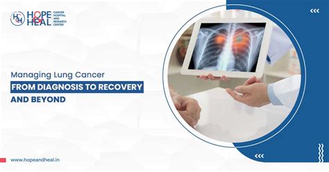 Managing Lung Cancer: Diagnosis to Recovery