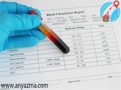 AST Blood Test 的图像结果